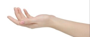 Przyczyny i mechanizmy powstawania przykurczu rozcięgna dłoniowego