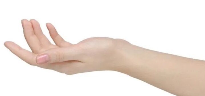 Przyczyny i mechanizmy powstawania przykurczu rozcięgna dłoniowego